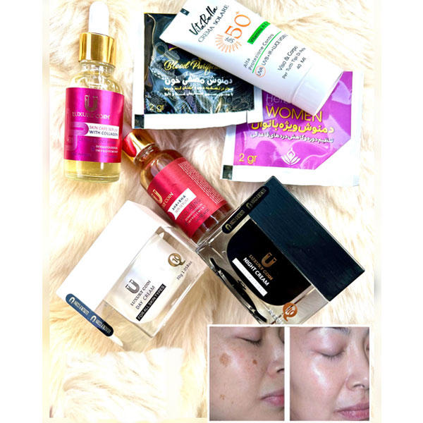 خرید پک پک رفع لک صورت لاکچری کوین