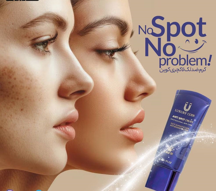 خرید آنلاین کرم ضدلک لاکچری