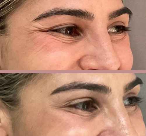 خرید و قیمت کرم رفع چین و چروک و ضد لک و آکنه بیوممتیک ویتامین سی گاتیو اصل