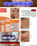 پک کرم بیوممتیک گاتیو + کرم ویتامین E ویتابلا ایتالیایی اصل ( همراه صابون روشن کننده رایگان)