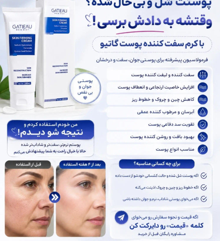 خری سفت کننده پوست بدن گاتیو کاهش چین وچروک